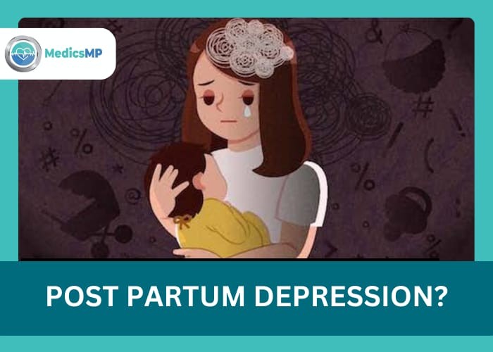 Postpartum Depression or Baby blues