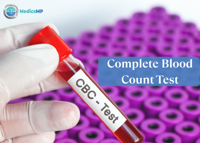 CBC Test Price in Pakistan: Everything You Need to Know