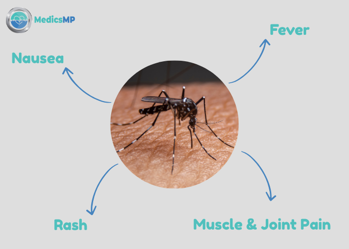 What to Eat in Dengue: Foods to Increase Platelets