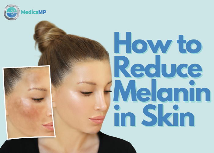 How to Reduce Melanin in Skin: Effective Ways for Even Skin Tone